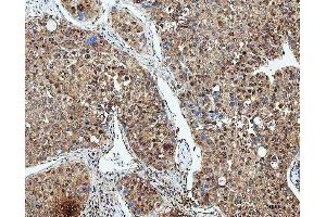 IHC analysis of SDE2 using anti-SDE2 antibody (ABIN7599603). (C1orf55 Antikörper  (AA 10-447))