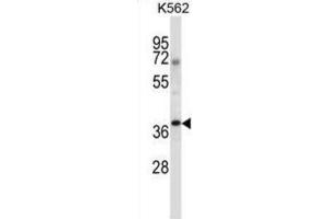 Western Blotting (WB) image for anti-NCK Adaptor Protein 1 (NCK1) antibody (ABIN2997496) (NCK1 Antikörper)