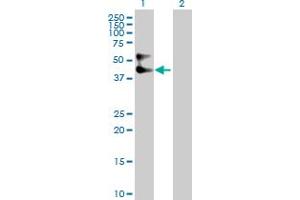 Western Blot analysis of SERPINA3 expression in transfected 293T cell line by SERPINA3 MaxPab polyclonal antibody. (SERPINA3 Antikörper  (AA 1-423))