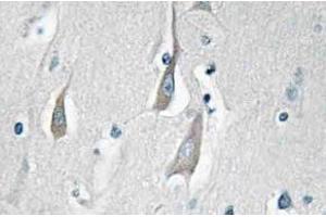 Immunohistochemistry (IHC) analyzes of p-CaMKIIalpha/delta antibody in paraffin-embedded human brain tissue. (CAMK2A Antikörper  (pThr286))