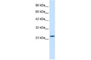 WB Suggested Anti-ZNF22 Antibody Titration:  1. (Zinc Finger Protein 22 Antikörper  (C-Term))