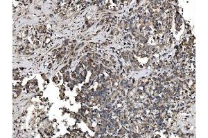IHC analysis of Astrin/Deepest/SPAG5 using anti-Astrin/Deepest/SPAG5 antibody (ABIN7602399). (SPAG5 Antikörper  (AA 738-1193))