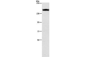 Western Blot analysis of A431 cell using ITGA2 Polyclonal Antibody at dilution of 1:300 (ITGA2 Antikörper)