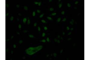 Immunofluorescence staining of Hela Cells with ABIN7127649 at 1:50, counter-stained with DAPI. (Rekombinanter NUP153 Antikörper)