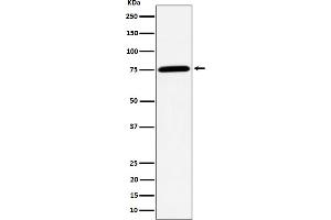 Western blot analysis of PPM1G expression in Jurkat cell lysate. (Rekombinanter PPM1G Antikörper)