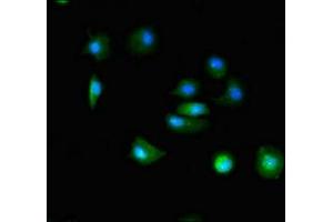 Immunofluorescent analysis of MCF-7 cells using ABIN7171915 at dilution of 1:100 and Alexa Fluor 488-congugated AffiniPure Goat Anti-Rabbit IgG(H+L) (TTC19 Antikörper  (AA 108-380))