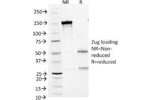 SDS-PAGE Analysis Purified CD1a Mouse Monoclonal Antibody (66IIC7).
