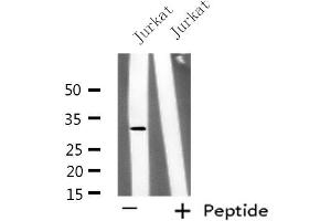 Western blot analysis of extracts from Jurkat cells, using KCNK6 antibody.