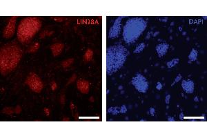 LIN28A antibody (pAb) tested by Immunocytochemistry Mouse embryonic stem cells (mESCs) grown on mouse embryonic fibroblast feeder cells (MEFs) were fixed with 4 % paraformaldehyde for 10 minutes at room temperature. (LIN28A Antikörper  (C-Term))