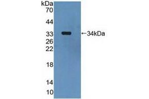 Western blot analysis of recombinant Human MAP2K6. (MAP2K6 Antikörper  (AA 46-306))