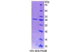 SDS-PAGE (SDS) image for Sperm Autoantigenic Protein 17 (SPA17) (AA 1-143) protein (His tag) (ABIN6238931)