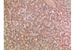 Immunohistochemical analysis of paraffin-embedded human-liver, antibody was diluted at 1:200 (CCR5 Antikörper  (AA 151-200))