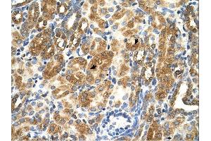 MAS1 antibody was used for immunohistochemistry at a concentration of 4-8 ug/ml. (MAS1 Antikörper  (Middle Region))