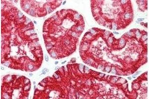 Human Kidney: Formalin-Fixed, Paraffin-Embedded (FFPE) (Aquaporin 1 Antikörper  (AA 241-269))
