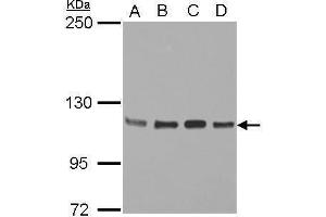 WB Image Sample (30 ug of whole cell lysate) A: Jurkat B: Raji C: K562 D: THP-1 5% SDS PAGE antibody diluted at 1:2000 (STAT2 Antikörper  (C-Term))
