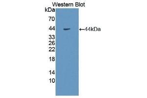 Western Blotting (WB) image for anti-Growth Hormone Receptor (GHR) (AA 315-574) antibody (ABIN3207347) (Growth Hormone Receptor Antikörper  (AA 315-574))