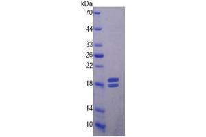 SDS-PAGE of Protein Standard from the Kit  (Highly purified E.