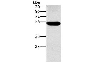 Western Blot analysis of Human placenta tissue using FUCA1 Polyclonal Antibody at dilution of 1:500 (FUCA1 Antikörper)