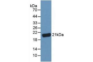 Detection of C8g in Human Serum using Polyclonal Antibody to Complement Component 8g (C8g) (C8G Antikörper  (AA 39-202))