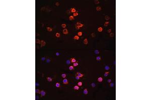 Immunofluorescence analysis of THP-1 cells using IL1β antibody (ABIN6128125, ABIN6142334, ABIN6142337 and ABIN6215185) at dilution of 1:100. (IL-1 beta Antikörper  (AA 124-223))