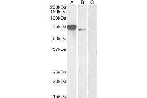 Western Blotting (WB) image for anti-Forkhead Box C1 (FOXC1) (C-Term) antibody (ABIN185028)