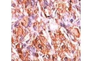Retinoblastoma Protein (Rb) Antikörper  (pSer811)