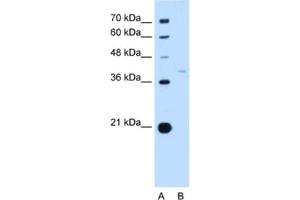 Western Blotting (WB) image for anti-Replication Factor C (Activator 1) 3, 38kDa (RFC3) antibody (ABIN2462934) (RFC3 Antikörper)