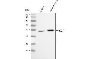 Western blot analysis of CBLIF using anti-CBLIF antibody (ABIN7599904). (CBLIF (AA 128-417) Antikörper)