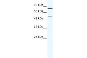WB Suggested Anti-ZNF12 Antibody Titration:  1. (ZNF12 Antikörper  (N-Term))