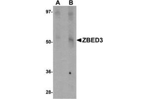 Western blot analysis of ZBED3 in rat lung tissue lysate with this product at (A) 1 and (B) 2 μg/ml. (ZBED3 Antikörper  (N-Term))