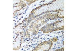 Immunohistochemistry of paraffin-embedded human stomach using ADH1C antibody (ABIN5997202) at dilution of 1/100 (40x lens). (ADH1C Antikörper)