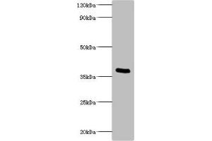 Western blot All lanes: Bordella pertussis pertussis toxin subunit 1 antibody at 2 μg/mL + recombinant Bordella pertussis pertussis toxin subunit 1 100 ng Secondary Goat polyclonal to rabbit IgG at 1/1000 dilution Predicted band size: 36 kDa Observed band size: 36 kDa (PtxA (AA 35-269) Antikörper)