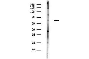 anti-CHMP Family, Member 7 (CHMP7) (N-Term) antibody