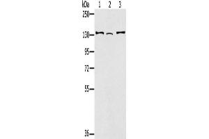 Gel: 6 % SDS-PAGE, Lysate: 40 μg, Lane 1-3: Hela cells, 231 cells, A172 cells, Primary antibody: ABIN7130904(RNF40 Antibody) at dilution 1/400, Secondary antibody: Goat anti rabbit IgG at 1/8000 dilution, Exposure time: 1 minute
