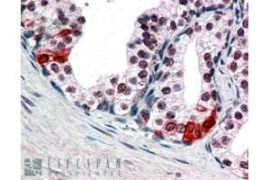 Immunohistochemistry (IHC) image for anti-SWI/SNF Related, Matrix Associated, Actin Dependent Regulator of Chromatin, Subfamily E, Member 1 (SMARCE1) (C-Term) antibody (ABIN185062)