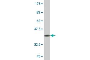 Western Blot detection against Immunogen (36. (EXOSC4 Antikörper  (AA 1-100))