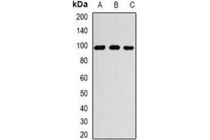 Western blot analysis of RANGAP1 expression in MCF7 (A), A549 (B), Jurkat (C) whole cell lysates. (RANGAP1 Antikörper)