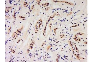 Formalin-fixed and paraffin embedded human kidney labeled with Anti-GSS/Glutathione Synthetase Polyclonal Antibody, Unconjugated  at 1:200 followed by conjugation to the secondary antibody and DAB staining. (Glutathione Synthetase Antikörper  (AA 81-160))