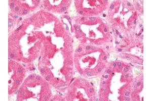 Immunohistochemistry (IHC) image for anti-Eukaryotic Translation Initiation Factor 4E Binding Protein 2 (EIF4EBP2) (AA 87-115) antibody (ABIN1890419)