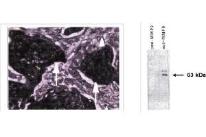 Immunohistochemistry (IHC) image for anti-Matrix Metallopeptidase 9 (Gelatinase B, 92kDa Gelatinase, 92kDa Type IV Collagenase) (MMP9) (active), (N-Term) antibody (ABIN264508) (MMP 9 Antikörper  (active, N-Term))