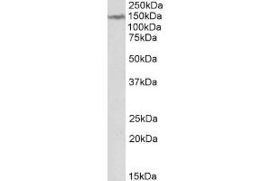 ABIN571234 (2µg/ml) staining of Human Cerebellum lysate (35µg protein in RIPA buffer). (LMTK2 Antikörper  (Internal Region))