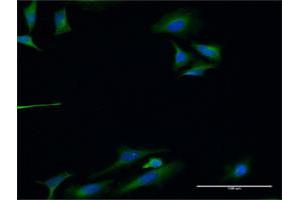 Immunofluorescence of monoclonal antibody to TLN1 on HeLa cell.