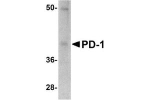 Western Blotting (WB) image for anti-Programmed Cell Death 1 (PDCD1) antibody (ABIN1031790) (PD-1 Antikörper)