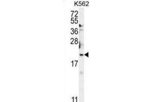 Western Blotting (WB) image for anti-BTG Family, Member 2 (BTG2) antibody (ABIN2995530) (BTG2 Antikörper)