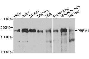 Western blot analysis of extracts of various cell lines, using PBRM1 antibody. (Polybromo 1 Antikörper  (AA 1-230))