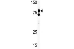 Western Blotting (WB) image for anti-Hepatocyte Growth Factor (Hepapoietin A, Scatter Factor) (HGF) (AA 521-554) antibody (ABIN3031186)