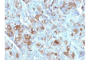 Formalin-fixed, paraffin-embedded human Adrenal Gland stained with Chromogranin A Mouse Monoclonal Antibody (CHGA/777) (Chromogranin A Antikörper)
