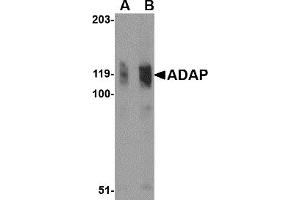 Image no. 1 for anti-FYN-Binding Protein (FYB) (N-Term) antibody (ABIN203719)