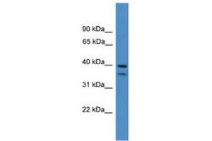 Image no. 1 for anti-serpin Peptidase Inhibitor, Clade B (Ovalbumin), Member 6 (SERPINB6) (AA 161-210) antibody (ABIN6745378) (SERPINB6 Antikörper  (AA 161-210))