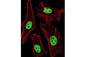 Fluorescent image of Hela cells stained with ARA Antibody (ABIN1944858 and ABIN2838532).